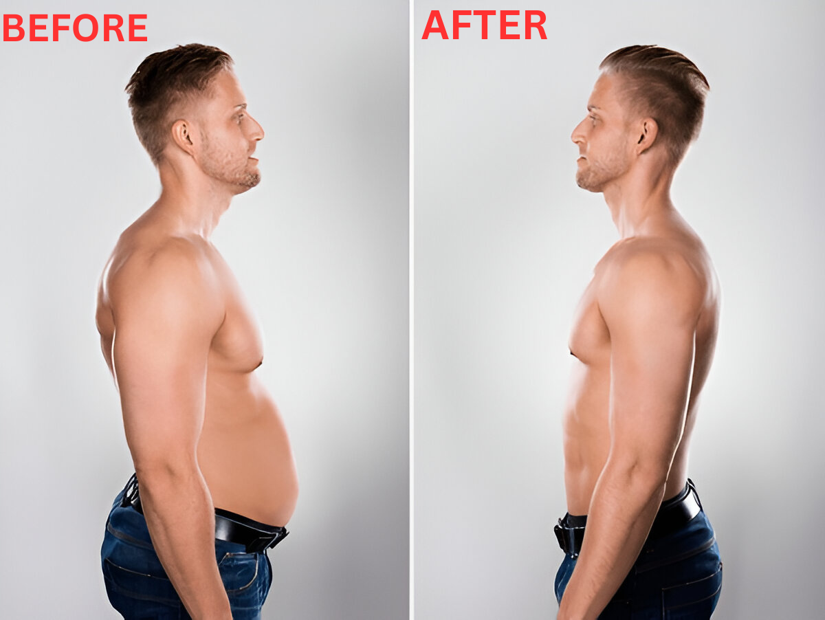 after-before-image